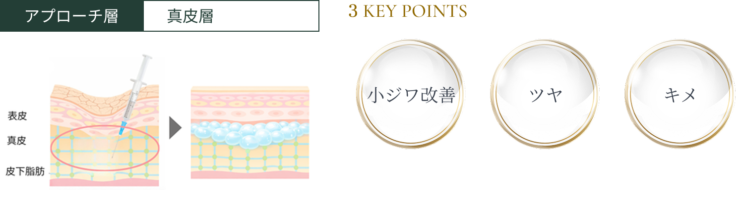 アプローチ層 真皮層