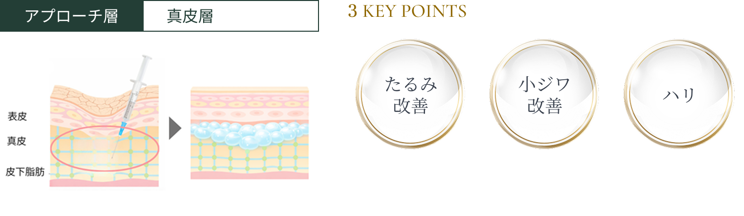 アプローチ層 真皮層