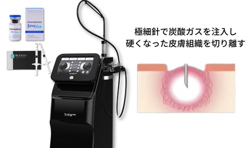 トライフィルプロ