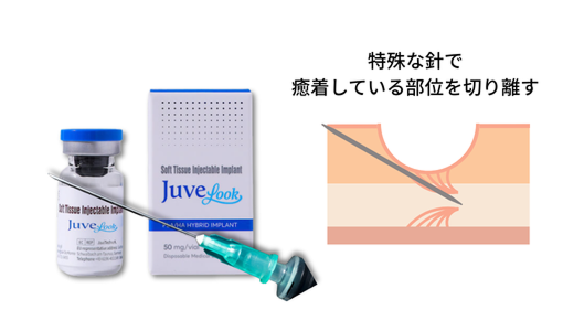 サブシジョン