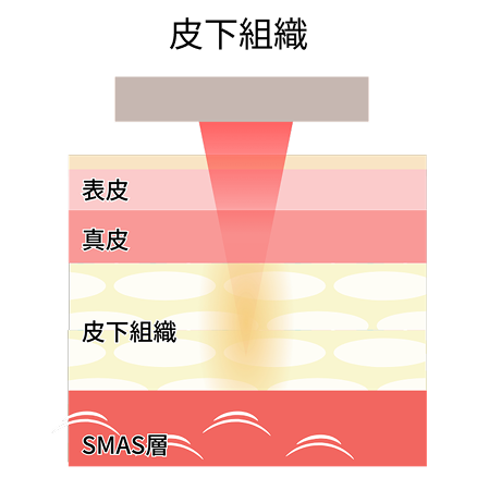 ボルニューマ：アプローチ層のイメージ