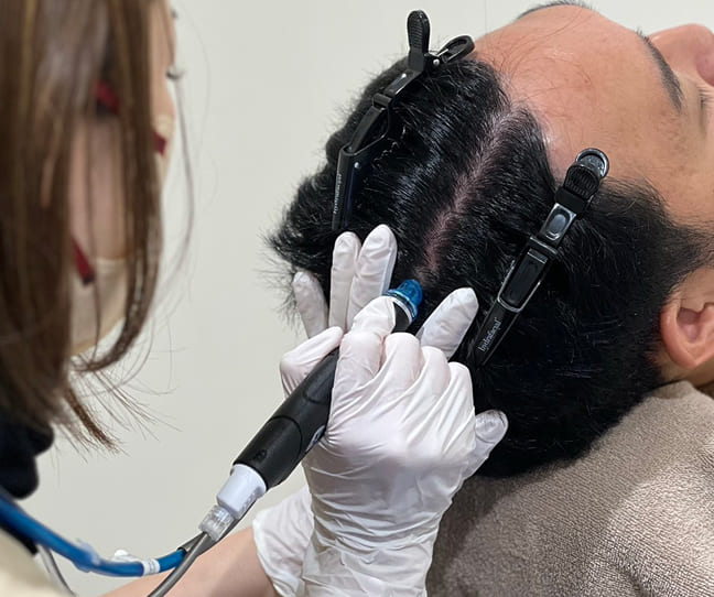 YAYOIの頭皮ケア