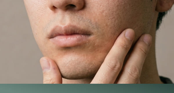 顔のたるみが気になる