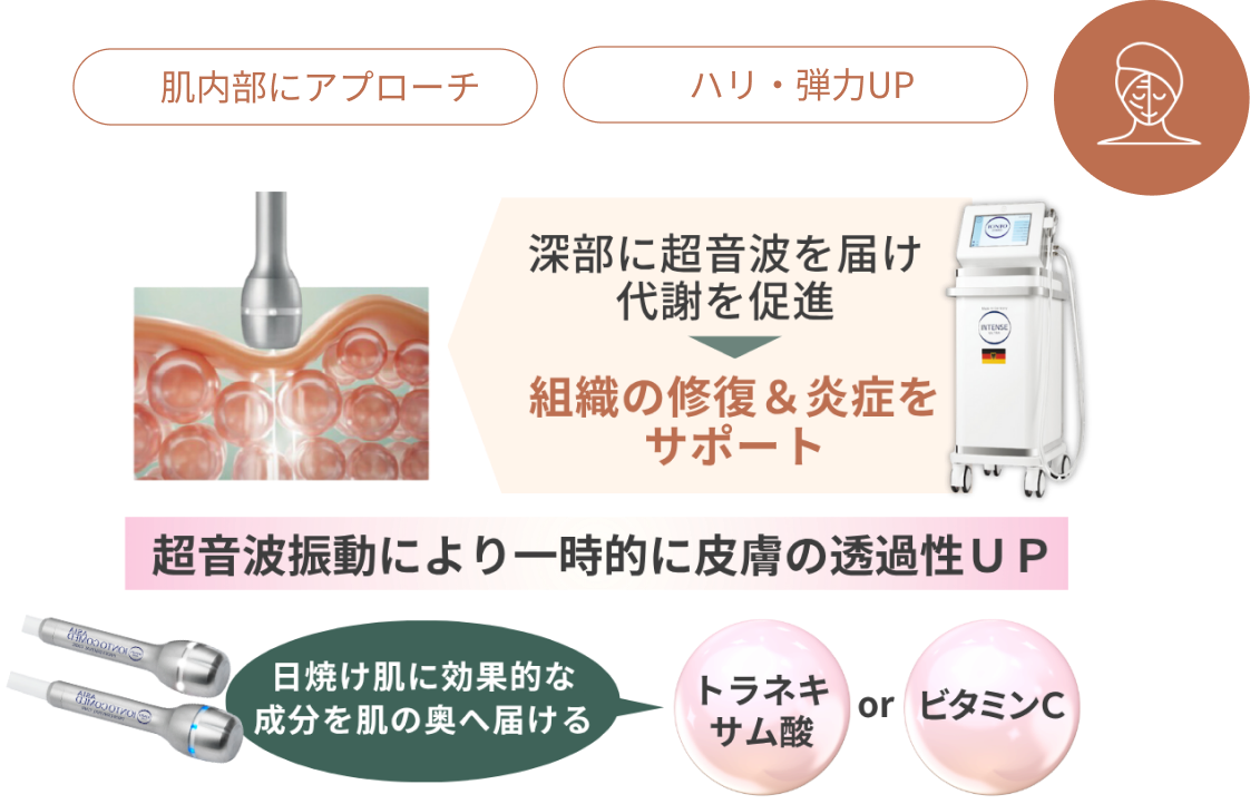 商品の図解
