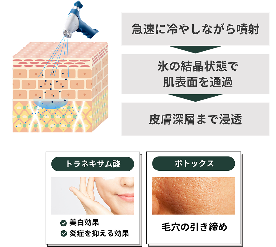 商品の図解