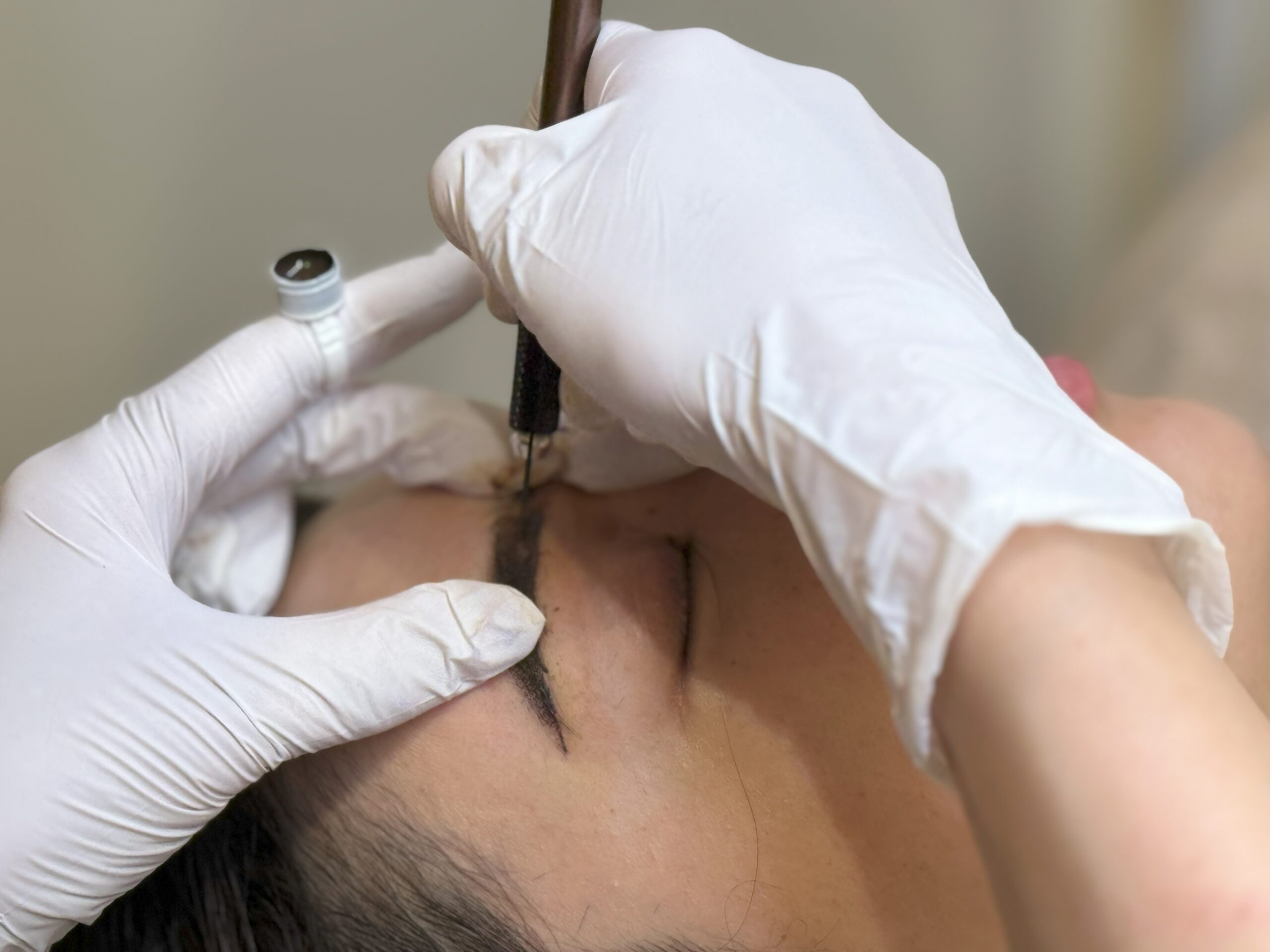 医療アートメイクを広島で受けるなら｜基本知識とヤヨイクリニックの特長