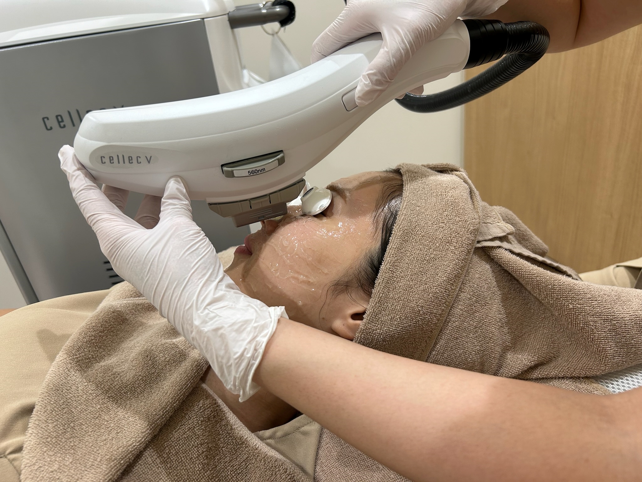 【広島の美容皮膚科】シミ取り治療の基礎知識！おすすめ施術もご紹介