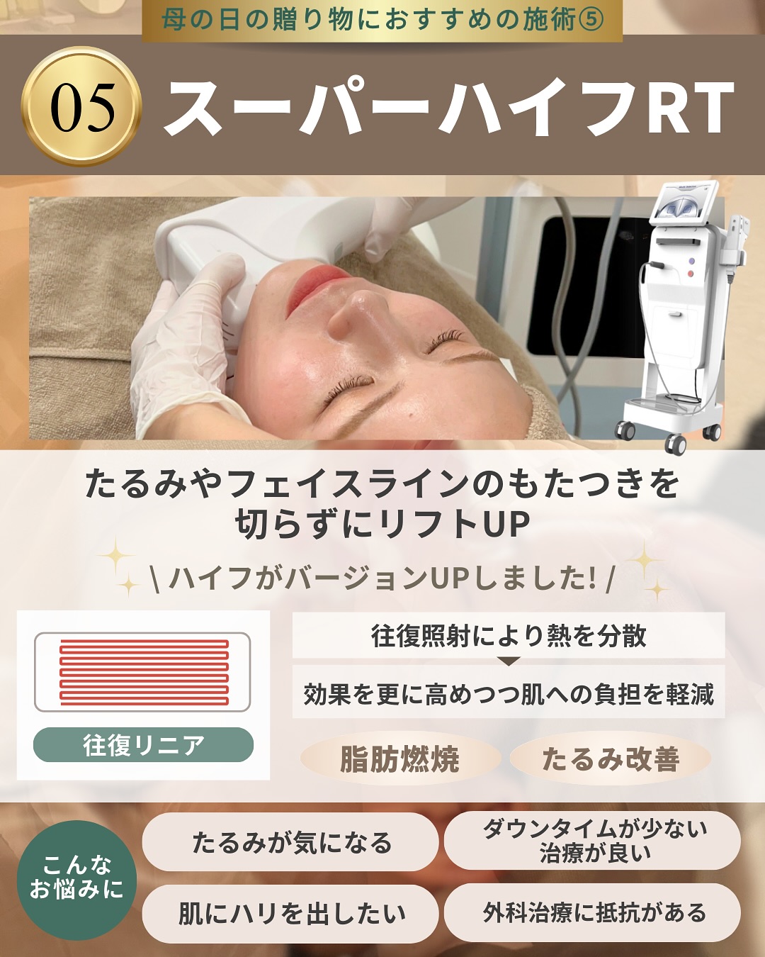 母の日におすすめの施術5│スーパーハイフ