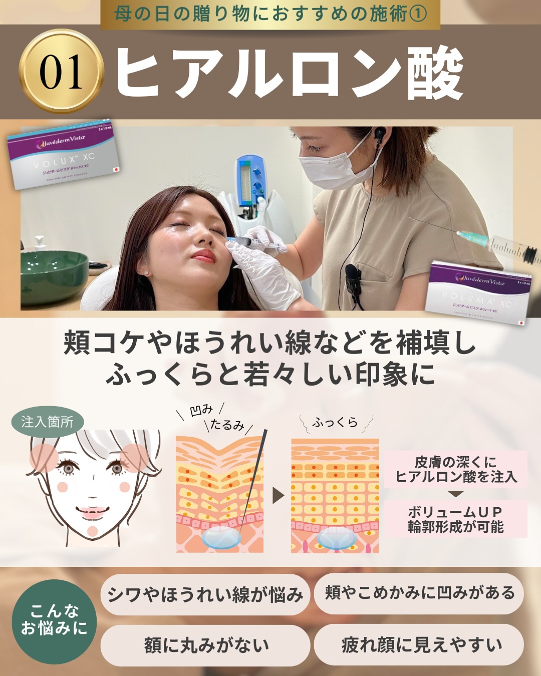 母の日におすすめの施術1│ヒアルロン酸