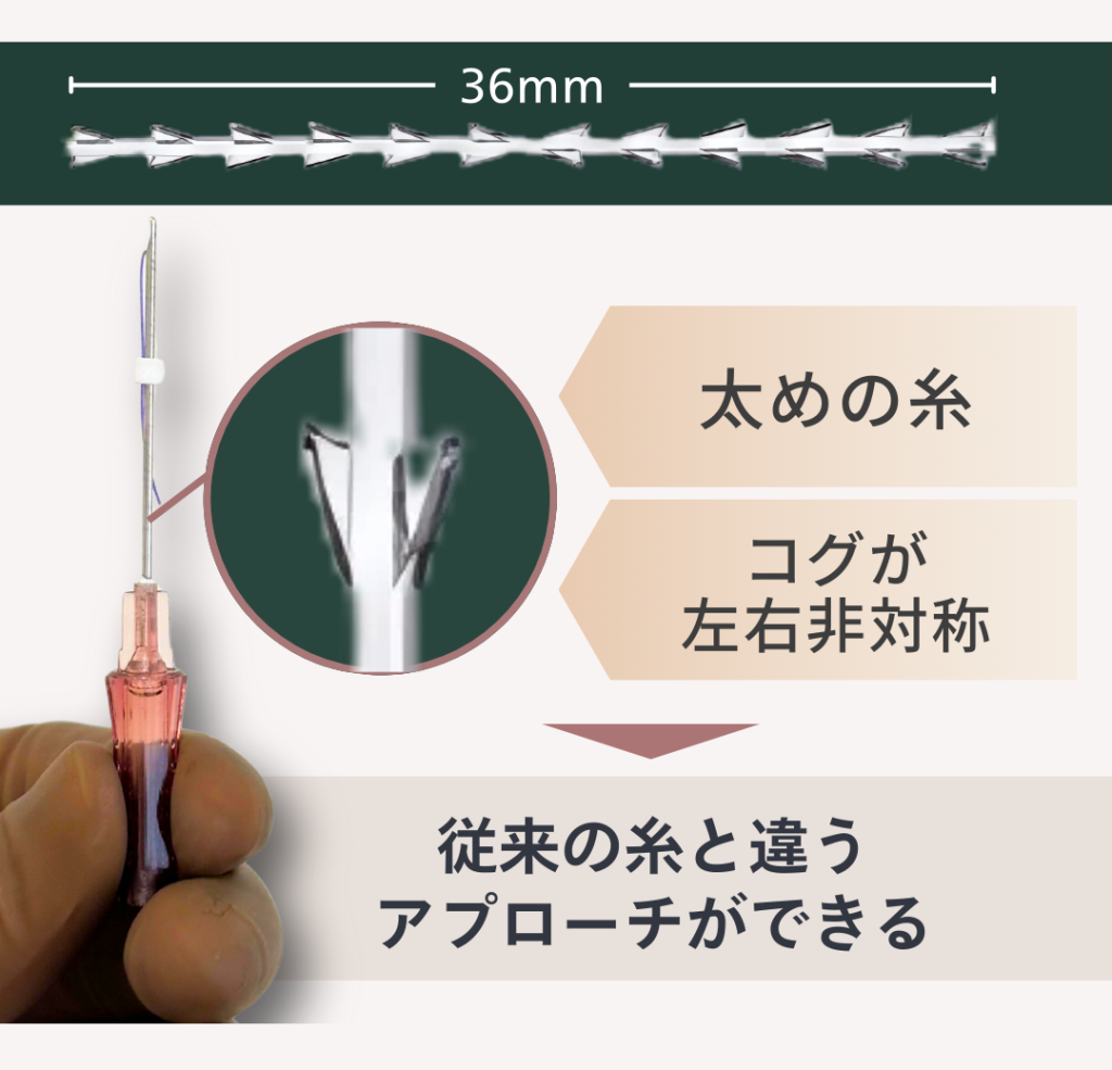 ぽにょりん
