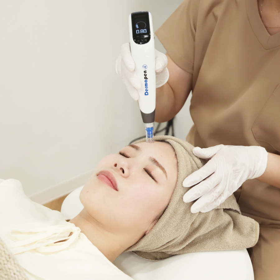 ニキビ痕治療｜皮膚科でできる治療法を広島のヤヨイクリニックが解説