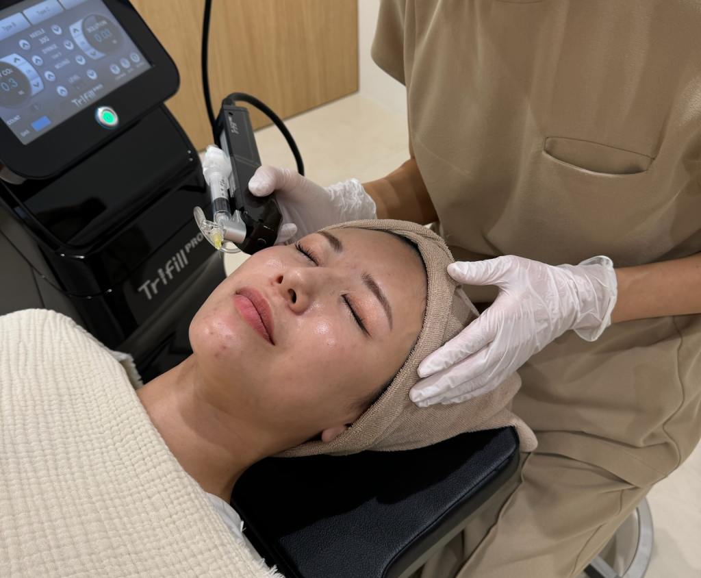 ニキビ痕のクレーターとは?治療方法を広島のヤヨイクリニックが徹底解説