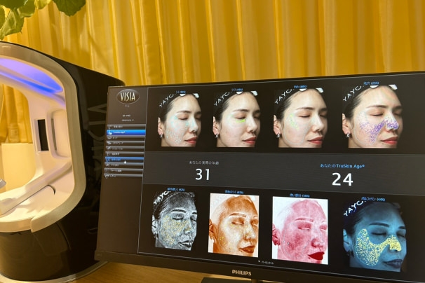 ニキビ痕のクレーターとは?治療方法を広島のヤヨイクリニックが徹底解説