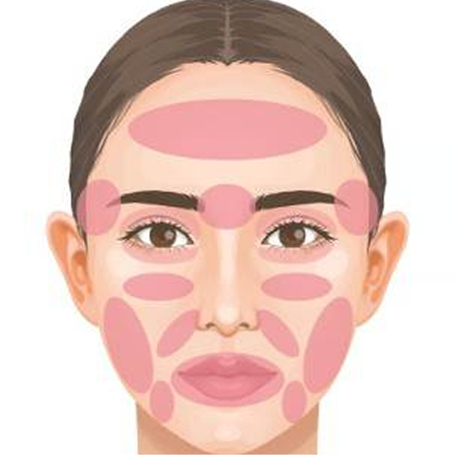 コンデンスリッチフェイス（CRF）