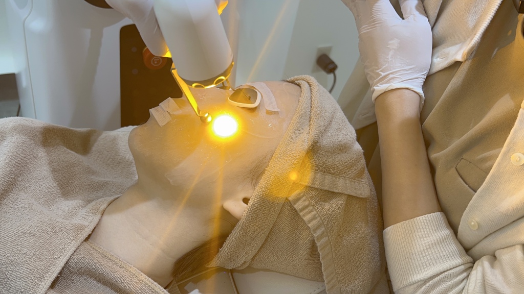 アドバテックスレーザー