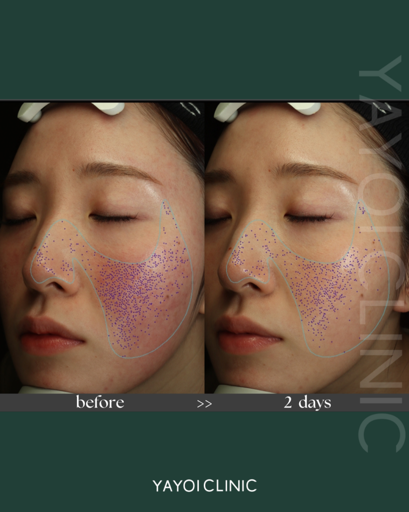 アドバテックス