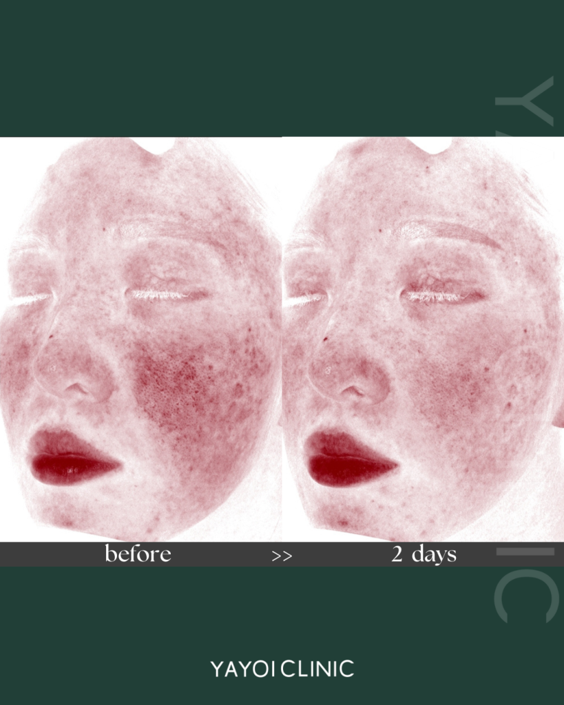 アドバテックス