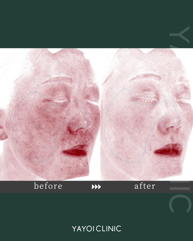 肌管理パーソナライズプラン