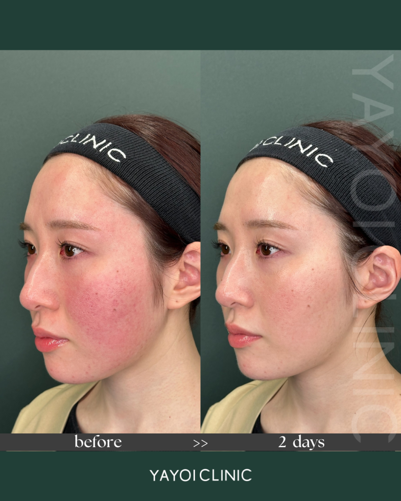 アドバテックス