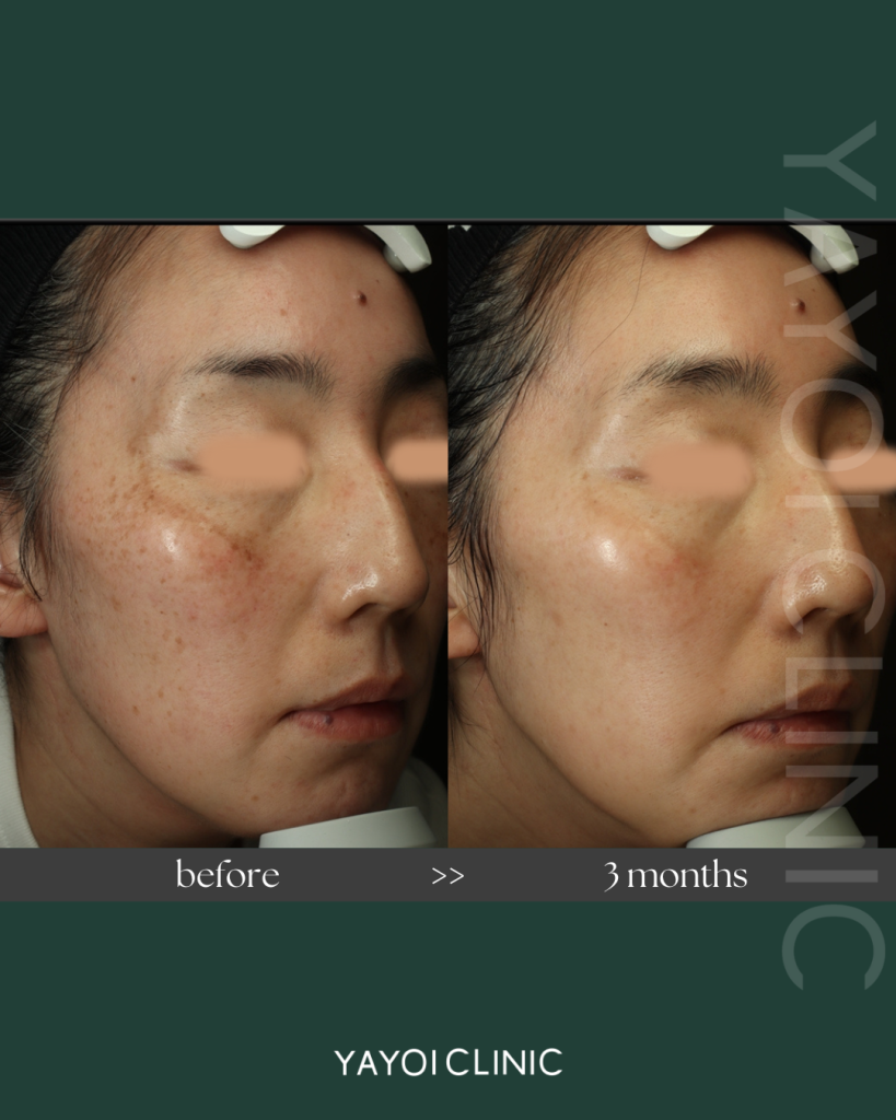 肌管理パーソナライズプラン