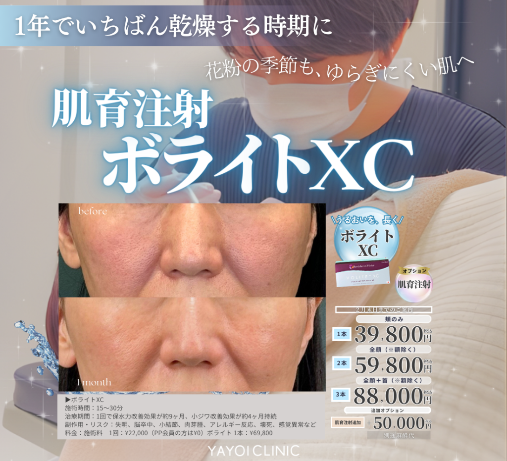 2月末日までのご案内🍫ボライトXC