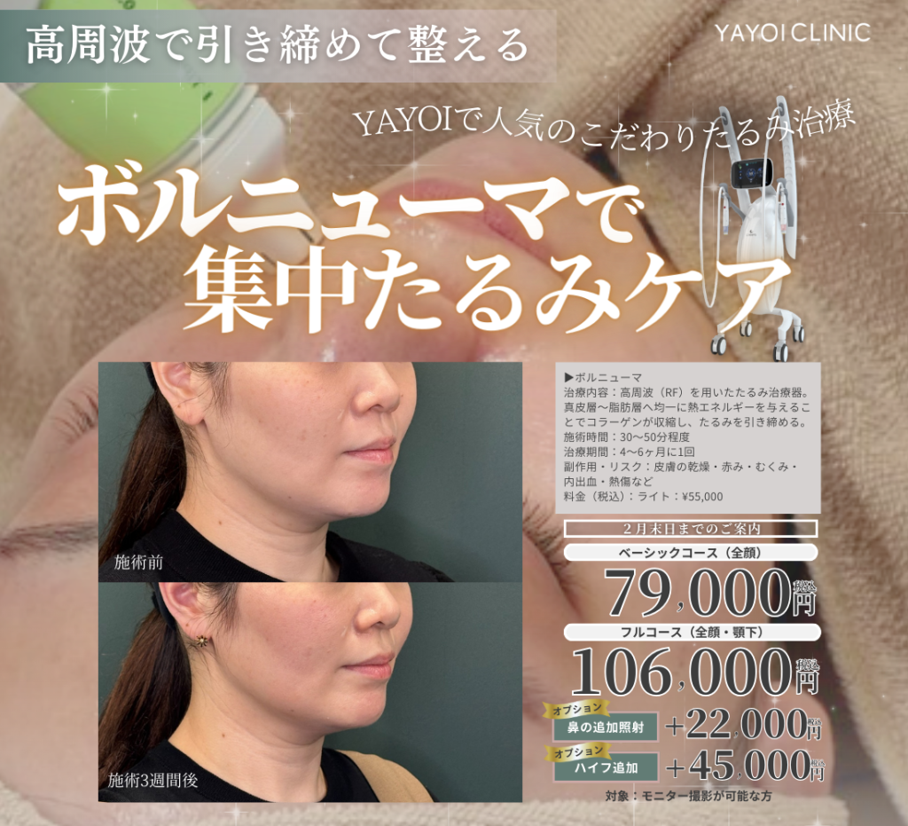 2月末日までのご案内🍫ボルニューマで集中たるみケア