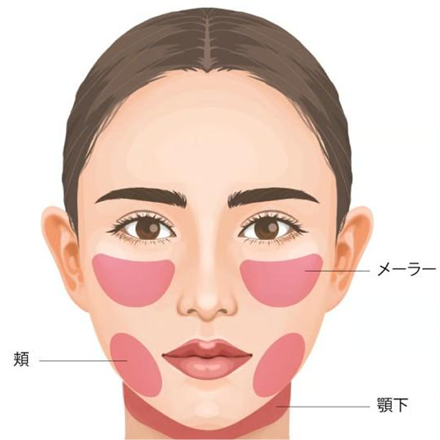 トータルフェイスサクション（メーラー/頬/顎下）