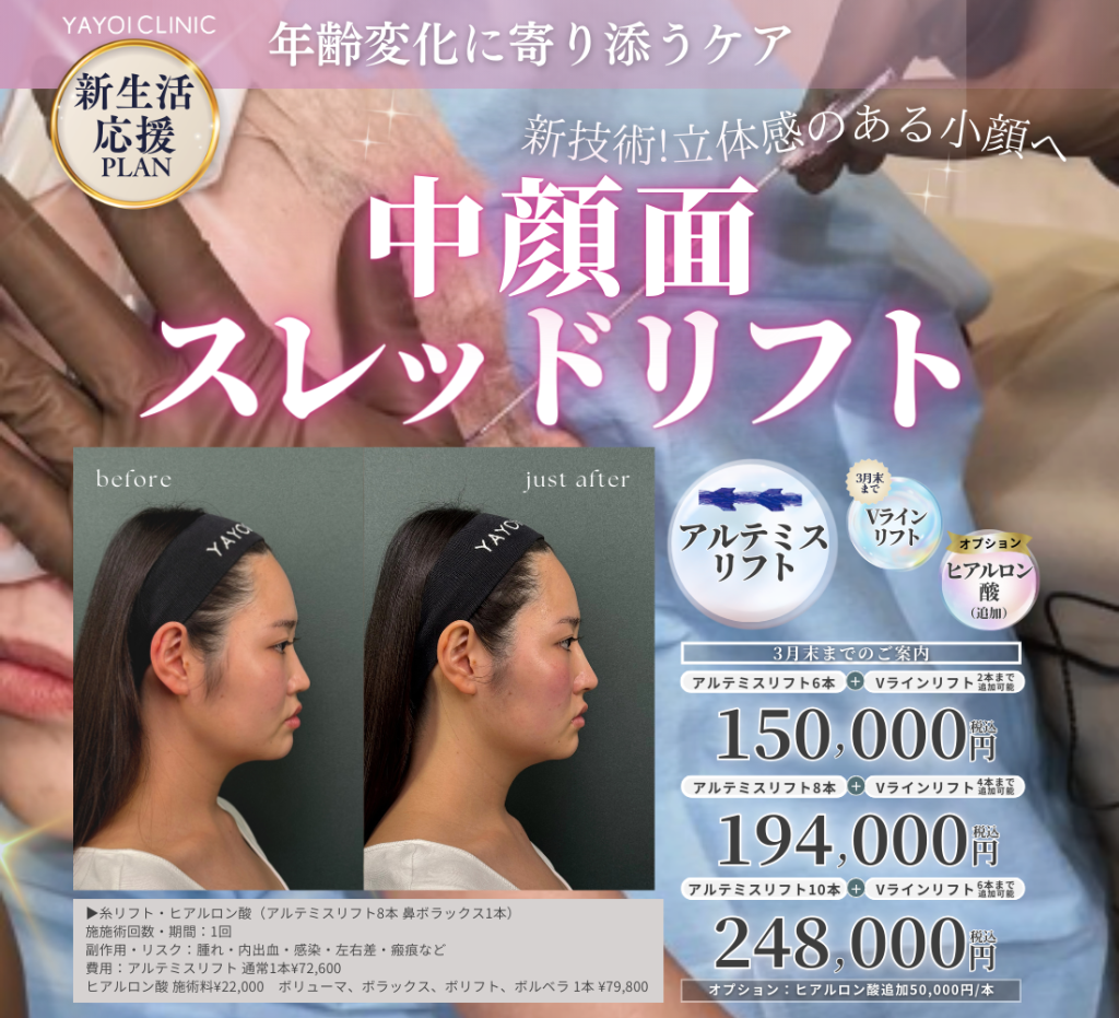 3月末日までのご案内🌱中顔面スレッドリフト