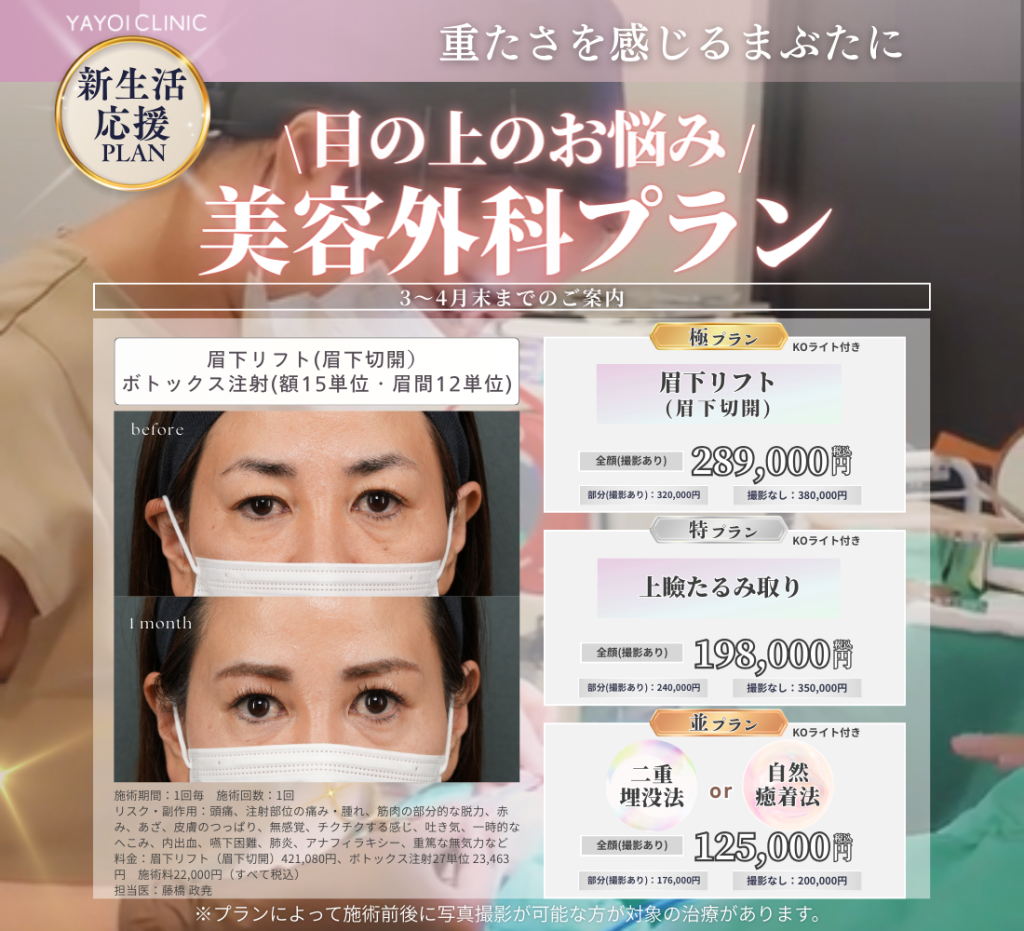 3～4月末日までのご案内🌱目の上のお悩み 美容外科プラン