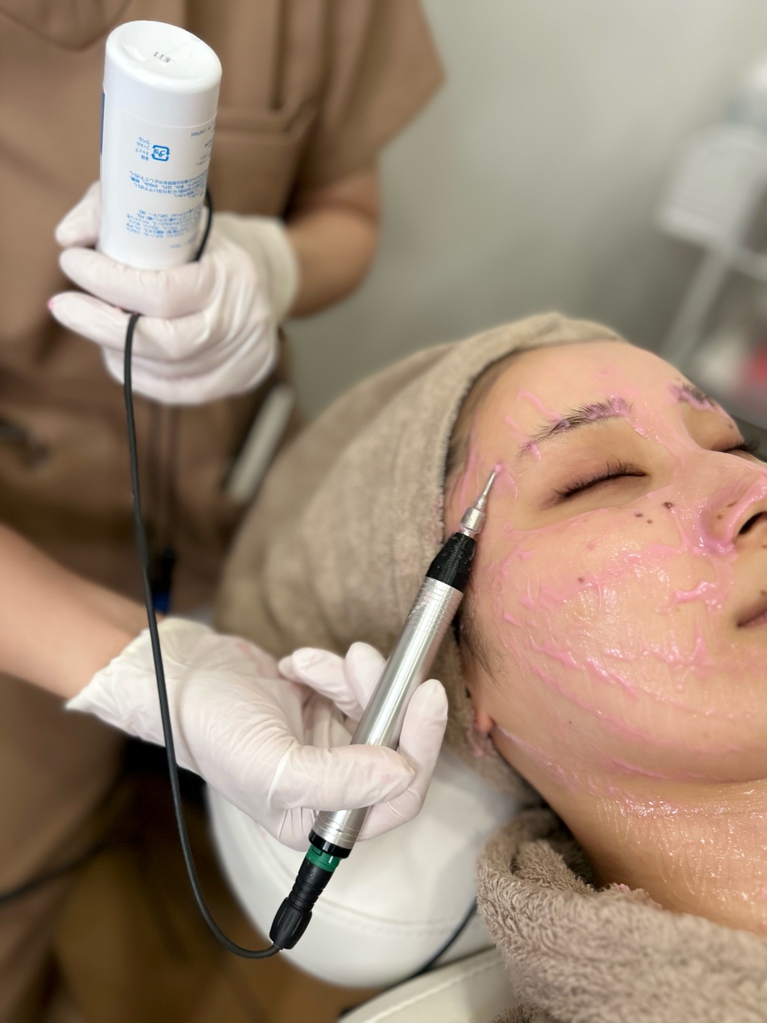 ニキビやニキビ痕の治療とは？広島の美容皮膚科ヤヨイクリニックが解説