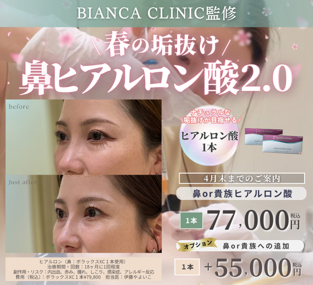 4月末までのご案内🌸鼻ヒアルロン酸2.0