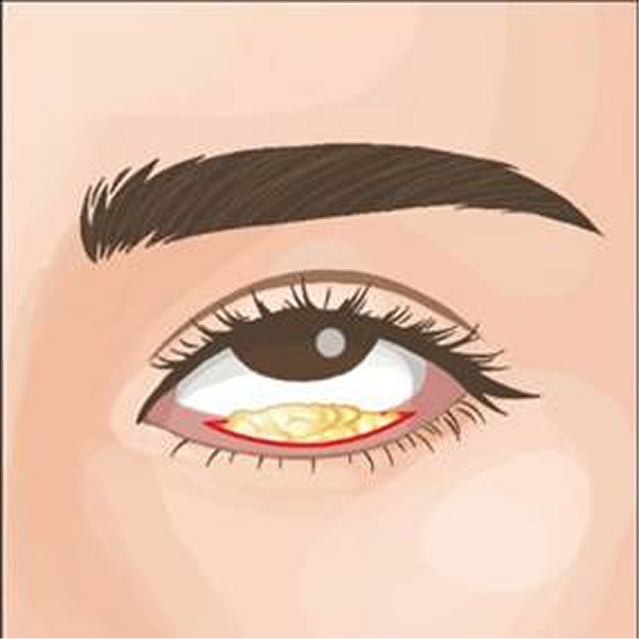 クマ取りを広島で！おすすめ施術やクリニック選びのポイントも解説