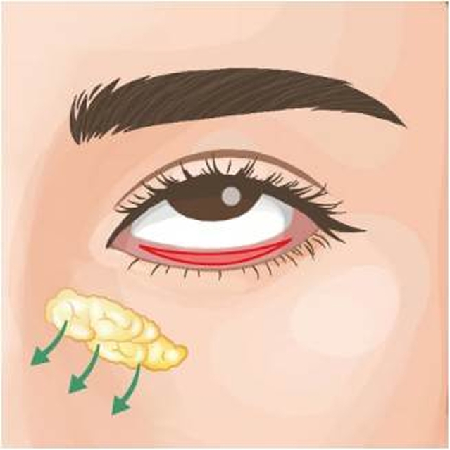 広島でクマ取りを!ダウンタイムの期間や効果的なケア方法を解説