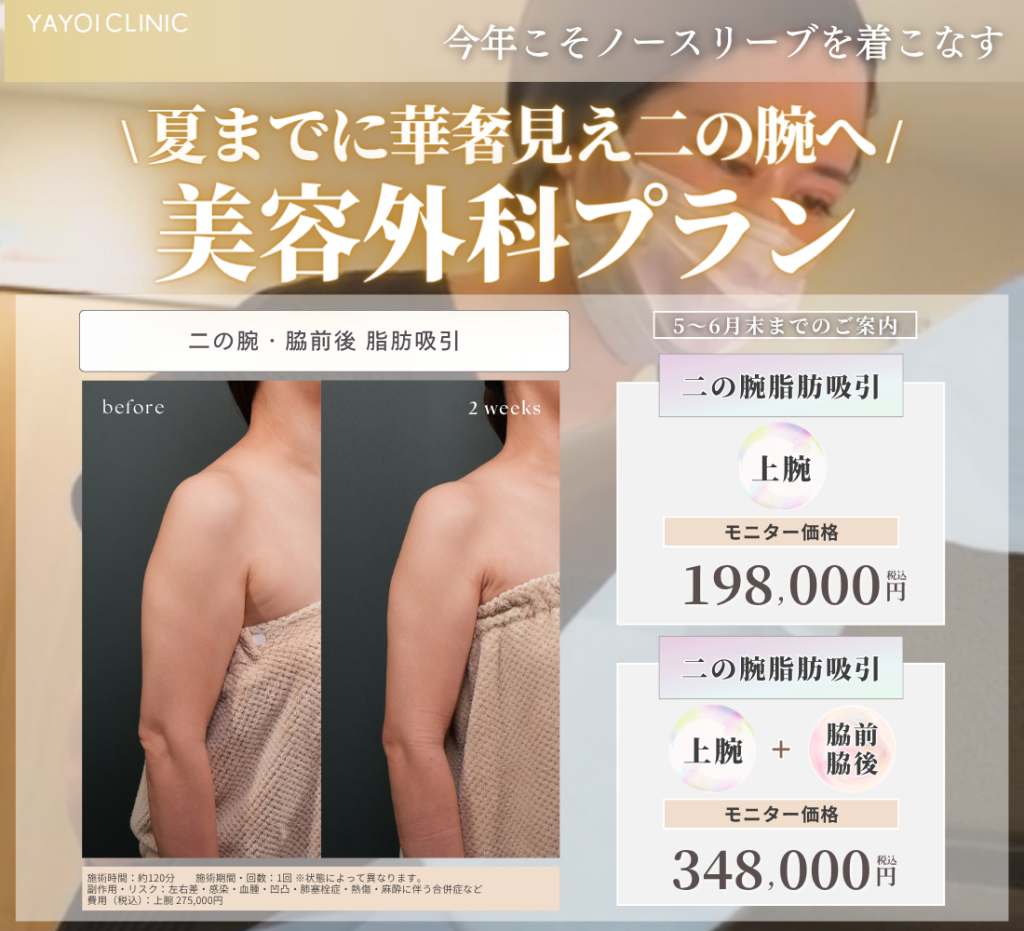 ５～６月末日までのご案内🌸二の腕のお悩み　美容外科プラン