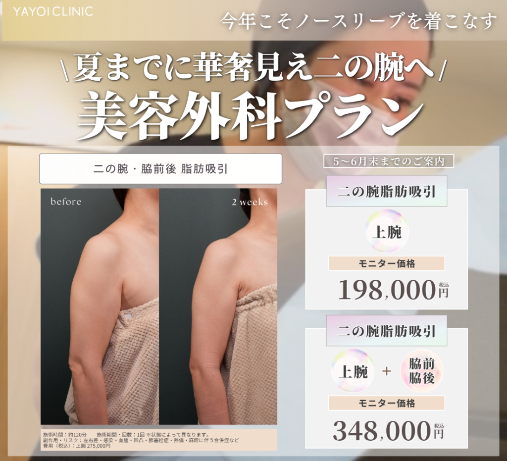 ５～６月末日までのご案内🌸二の腕のお悩み　美容外科プラン