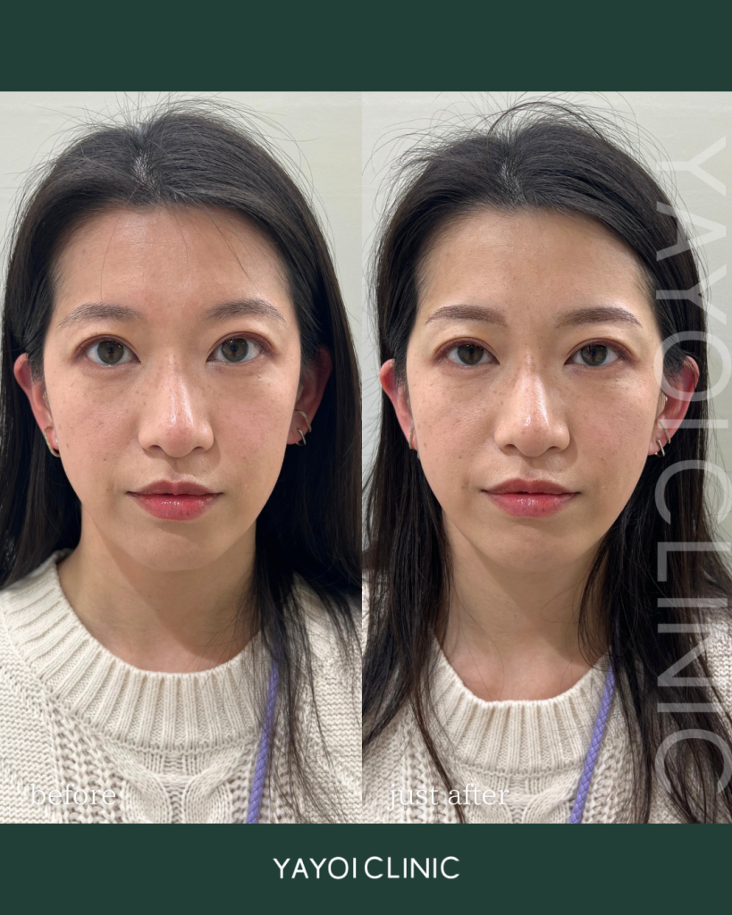 アートメイク（眉）
