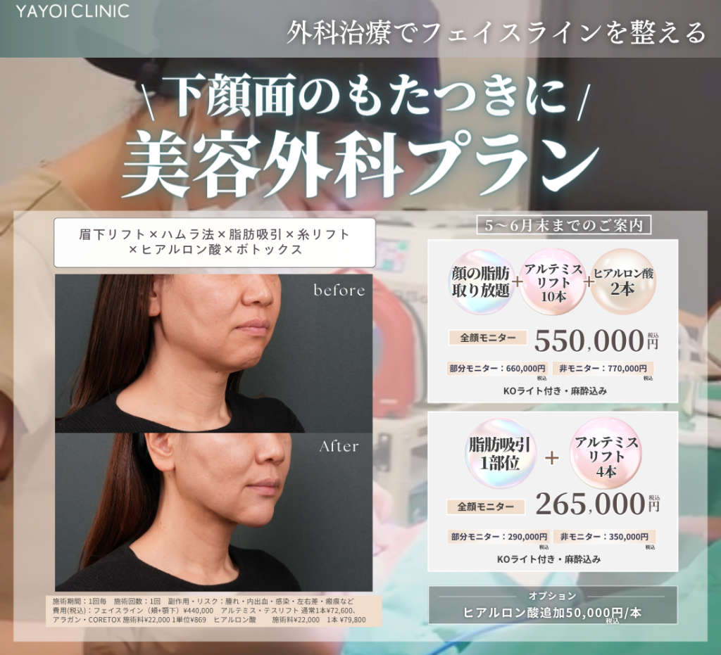 ５～６月末日までのご案内🌸下顔面のたるみのお悩み　美容外科プラン