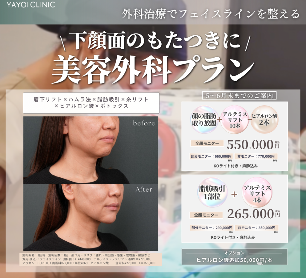 ５～６月末日までのご案内🌸下顔面のたるみのお悩み　美容外科プラン