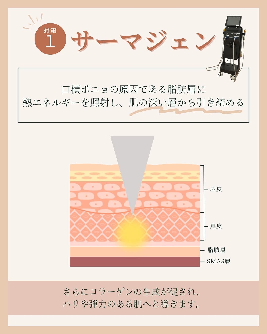 サーマジェンとは?