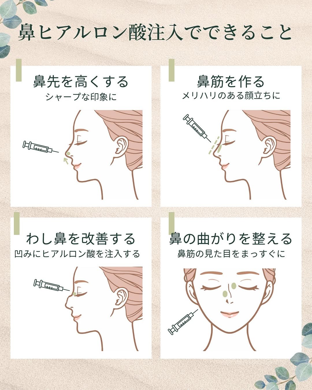 鼻ヒアルロン酸注入でできること