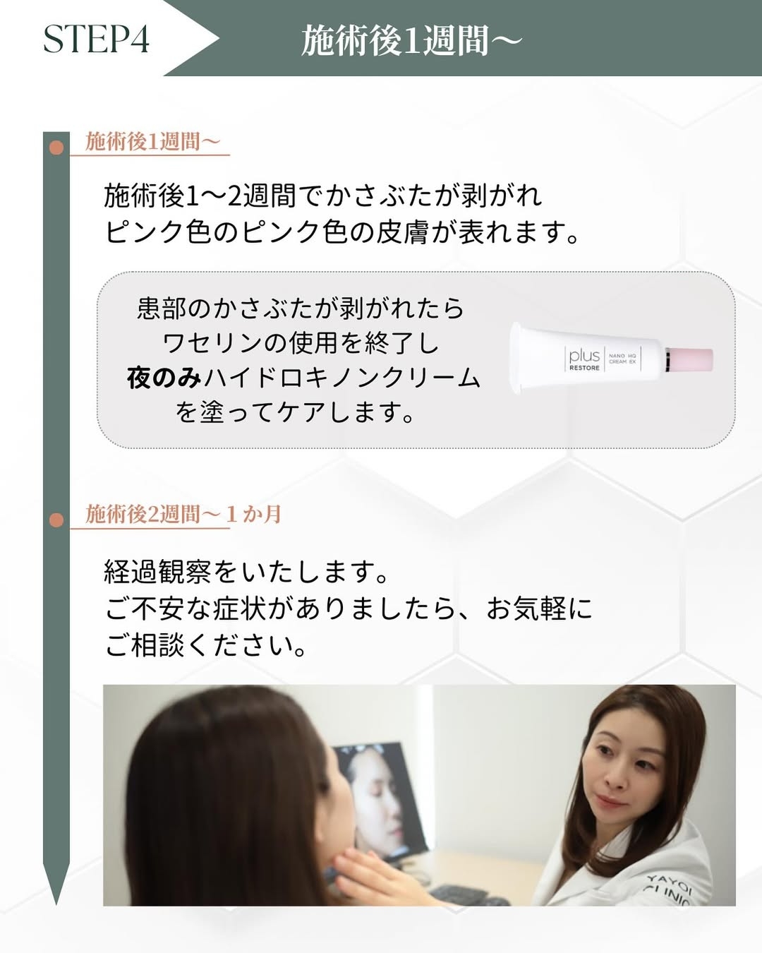 シミ取り後 1週間~