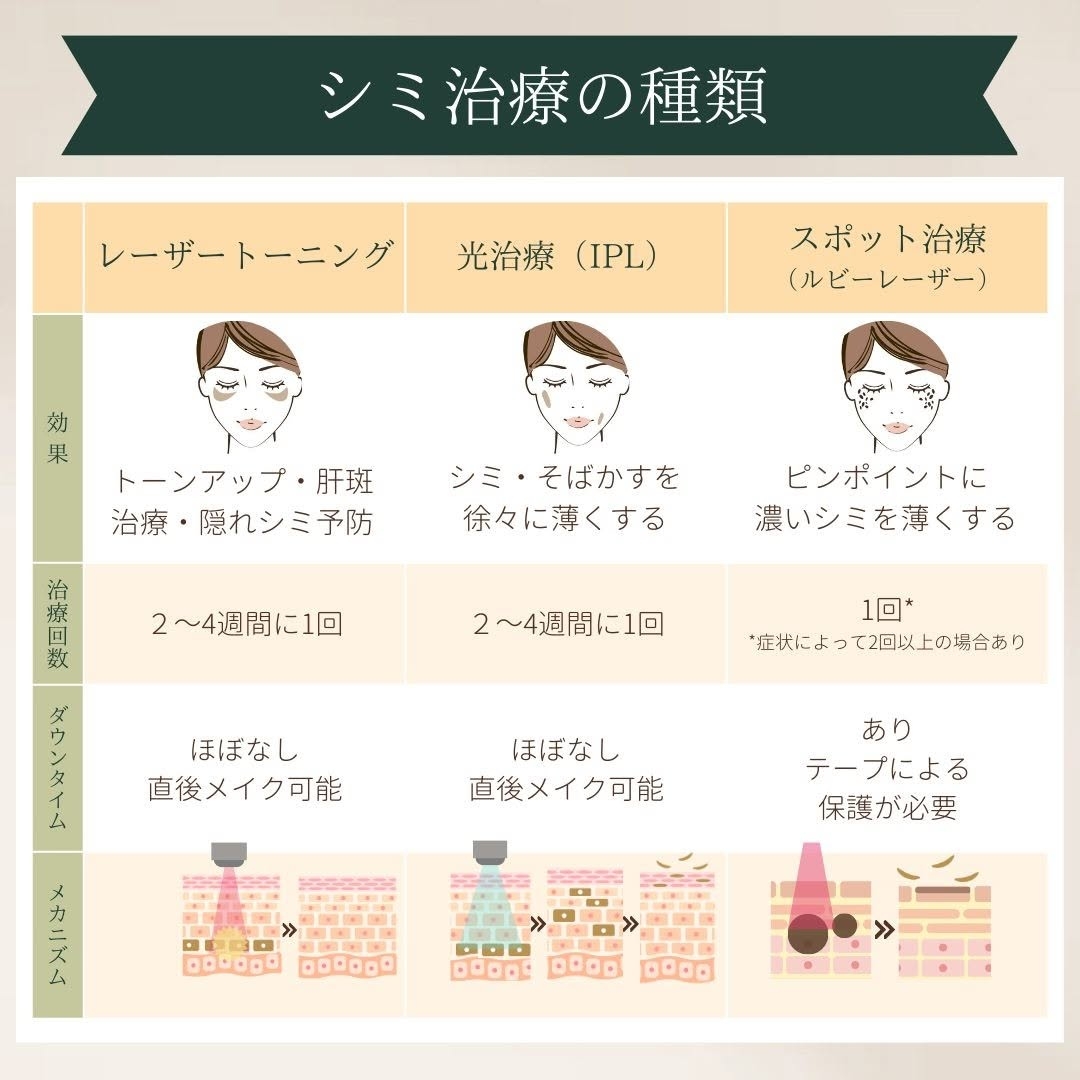 シミ治療の種類