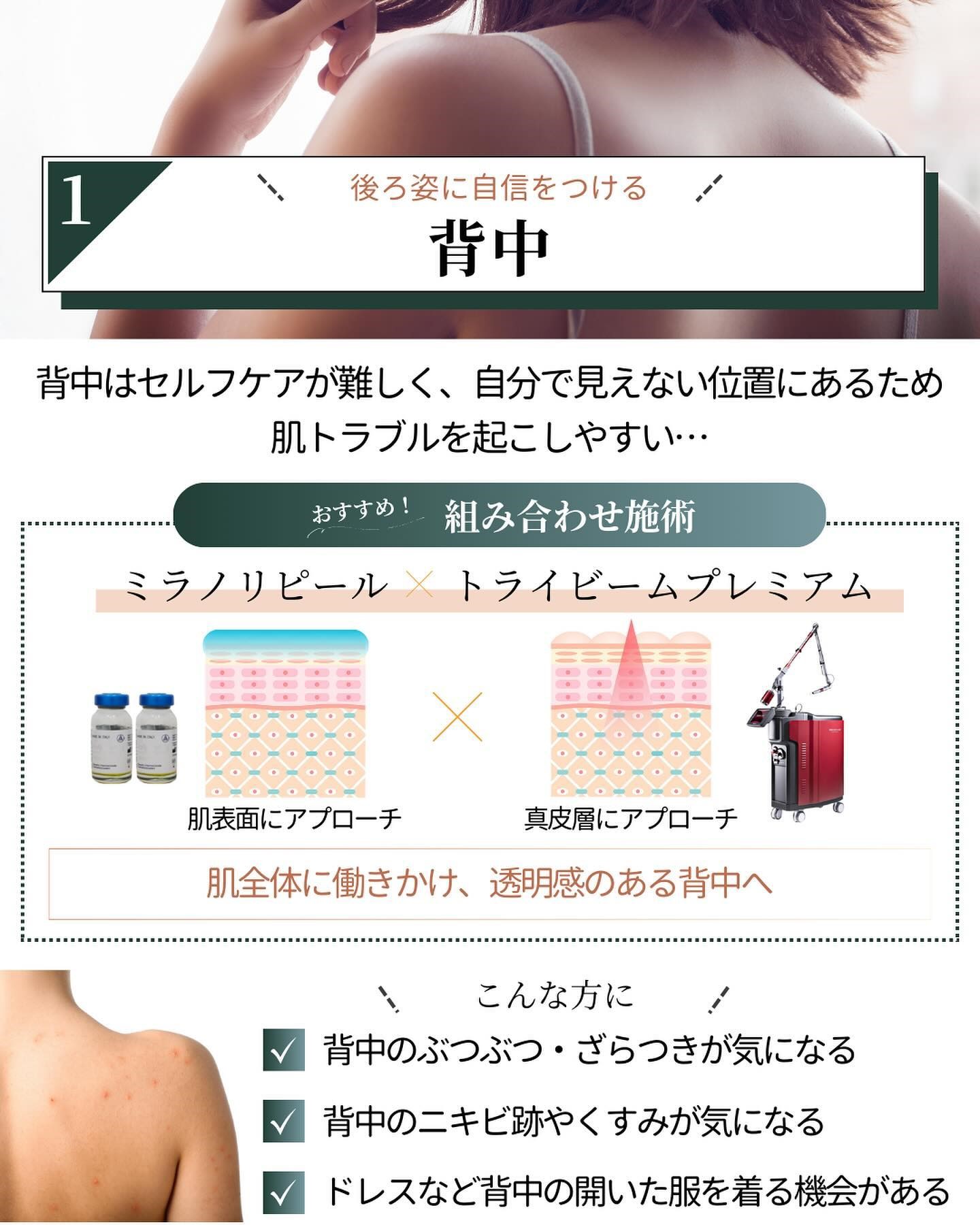 ミラノリピールとトライビームプレミアム