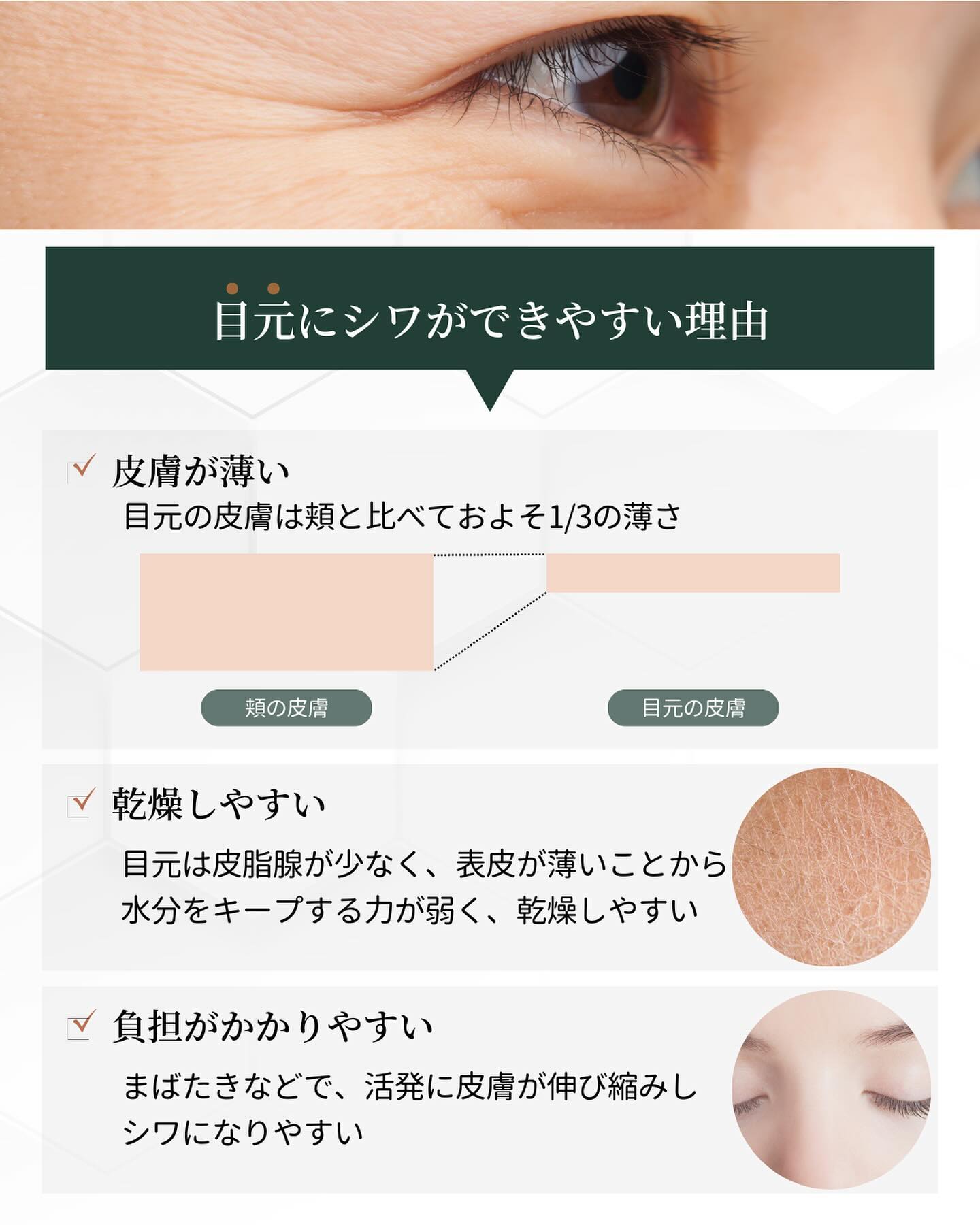 シワの原因とは