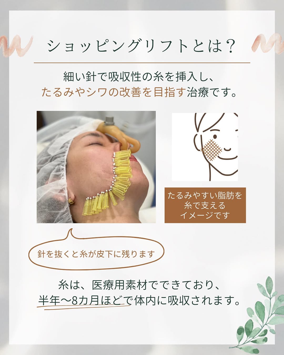 ショッピングリフトとは