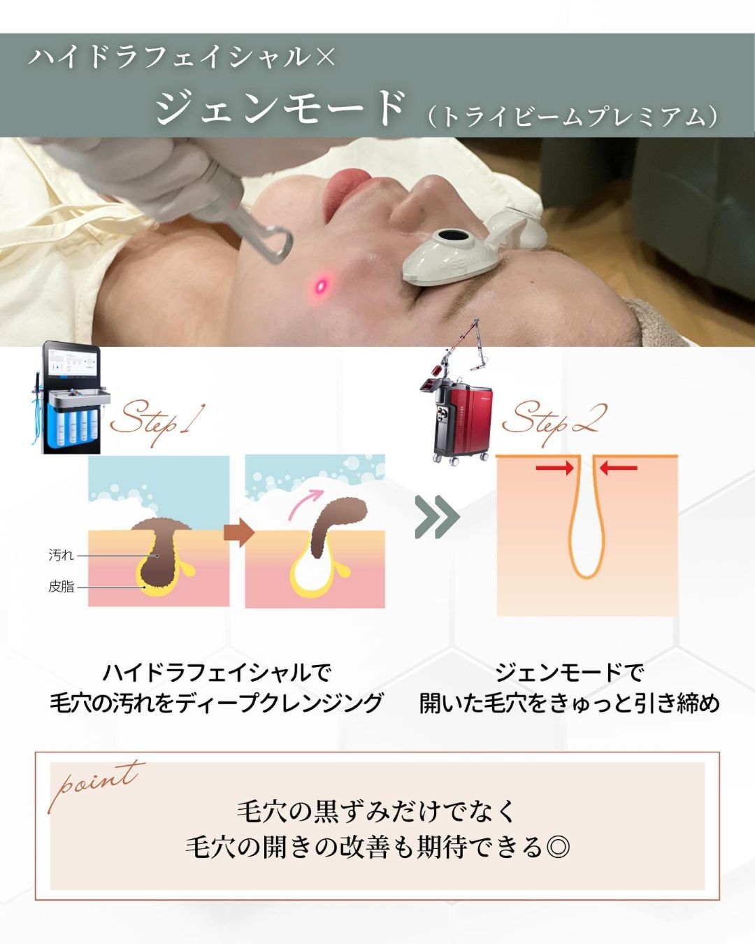 ハイドラフェイシャル ジェンモード トライビームプレミアム