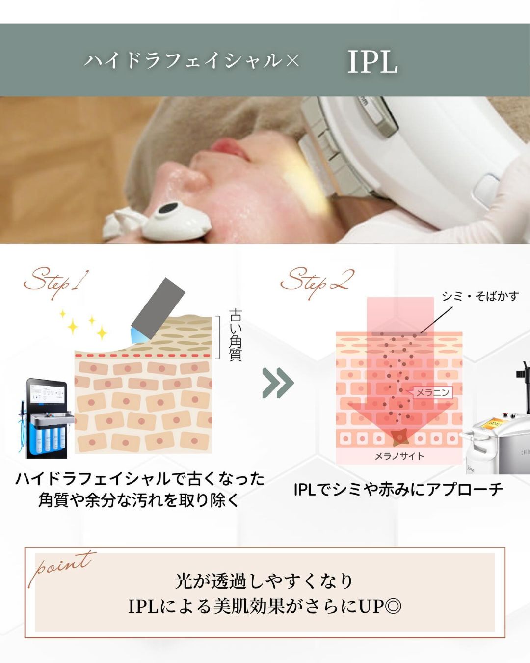 ハイドラフェイシャルIPL