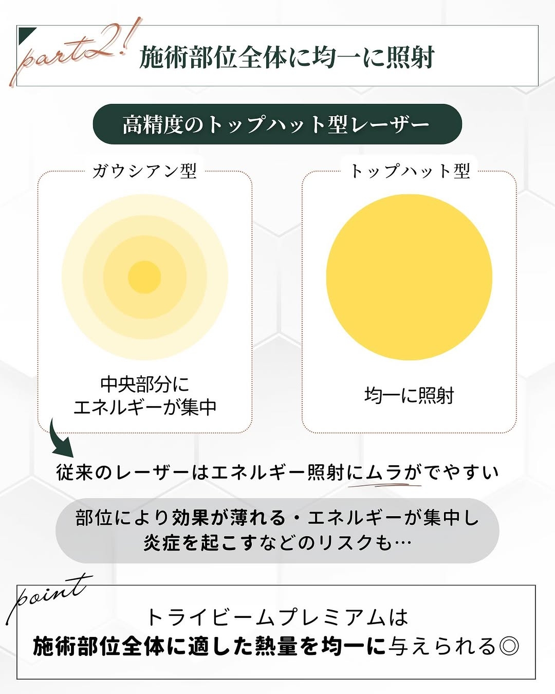 トライビームのレーザー