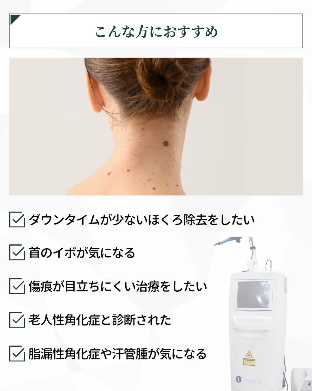 アキュパルス おすすめの人