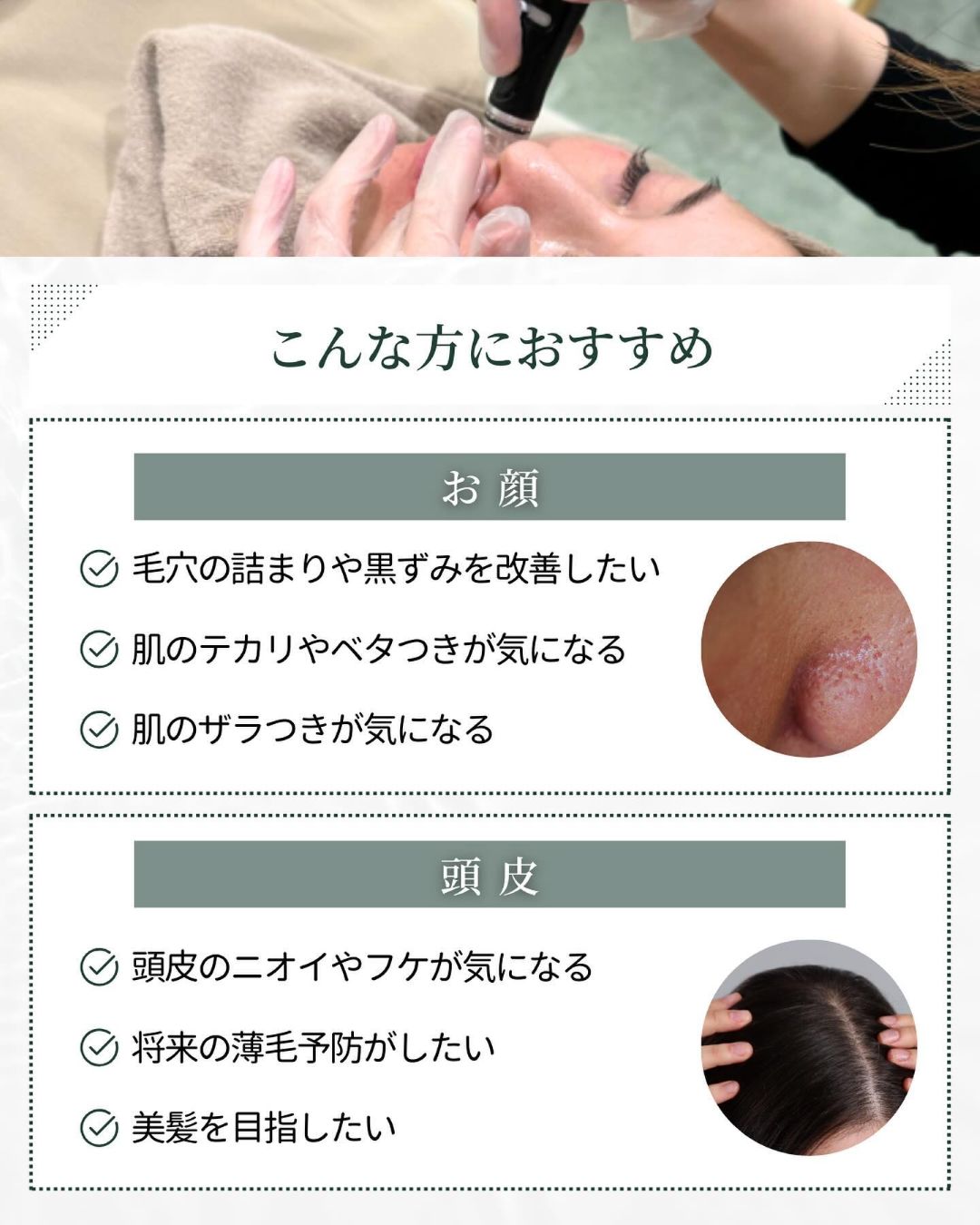 ハイドラフェイシャルがおすすめの人